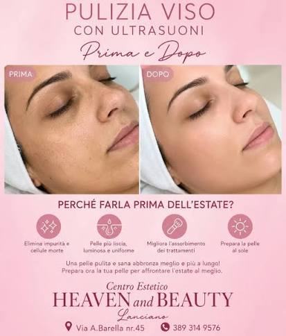 Pulizia Viso con Ultrasuoni